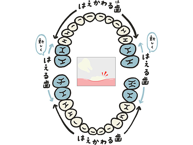 乳歯の抜歯