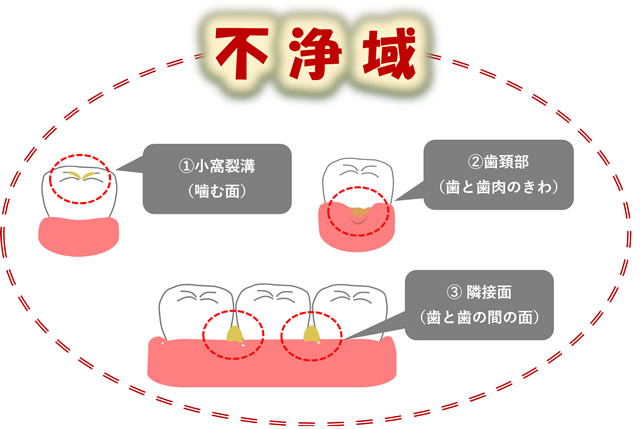 自浄域と不潔域とは？