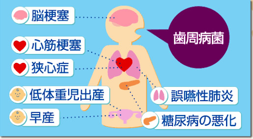 訪問口腔ケア